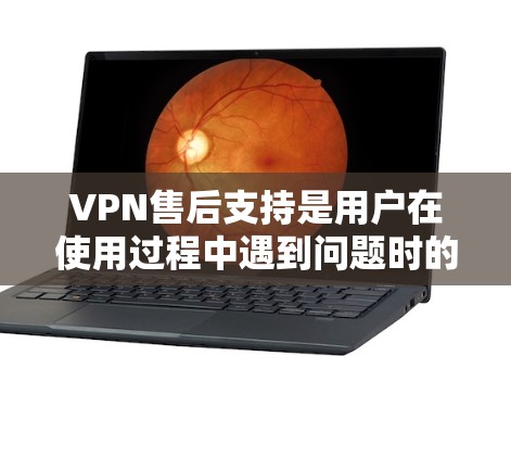 VPN售后支持是用户在使用过程中遇到问题时的保障措施。以下是对VPN售后支持的详细分析，涵盖不同类型的VPN平台及其售后支持服务